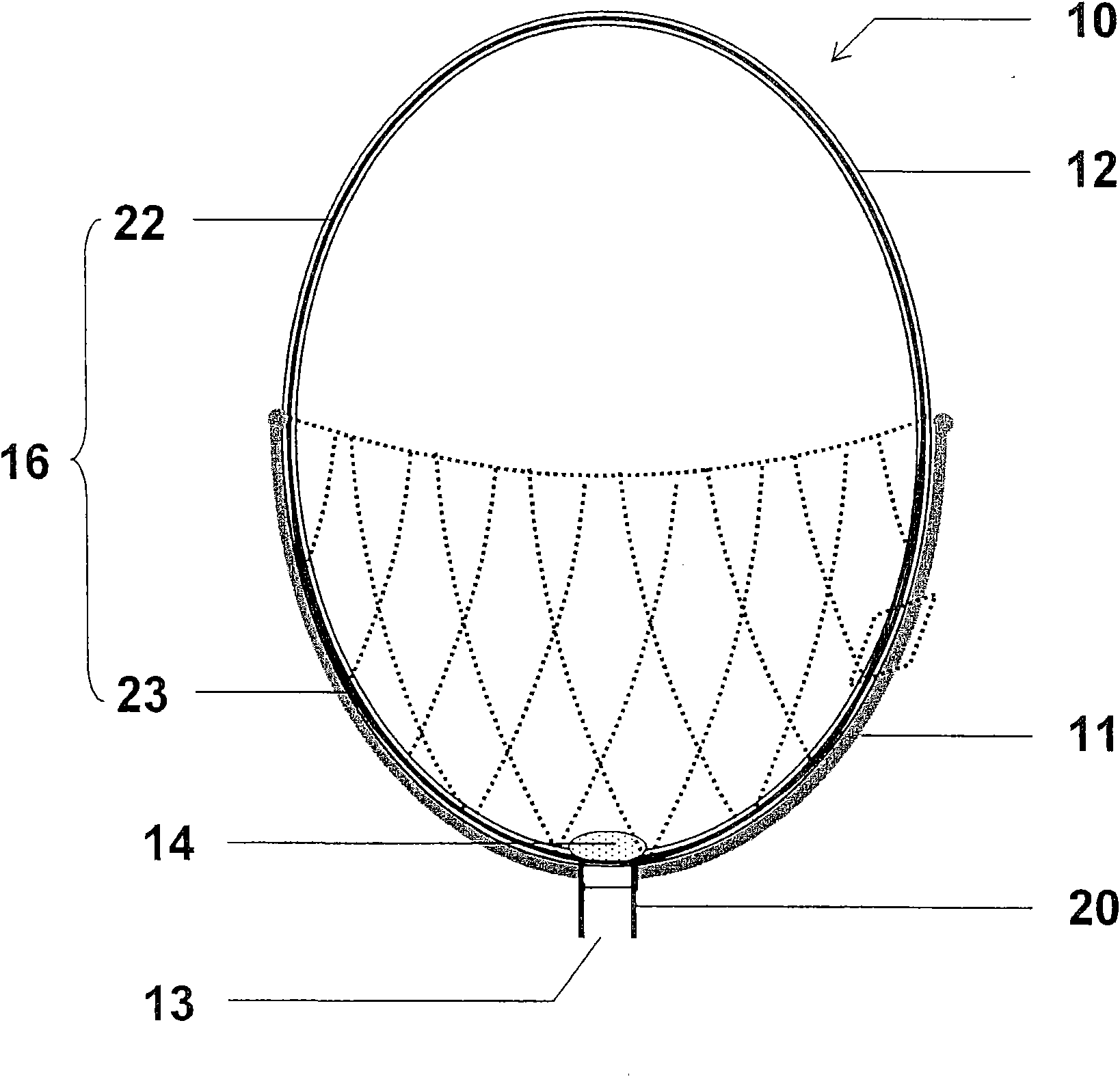 Cardiac impulse assist device, cardiac impulse assist system and method for treating cardiac failure