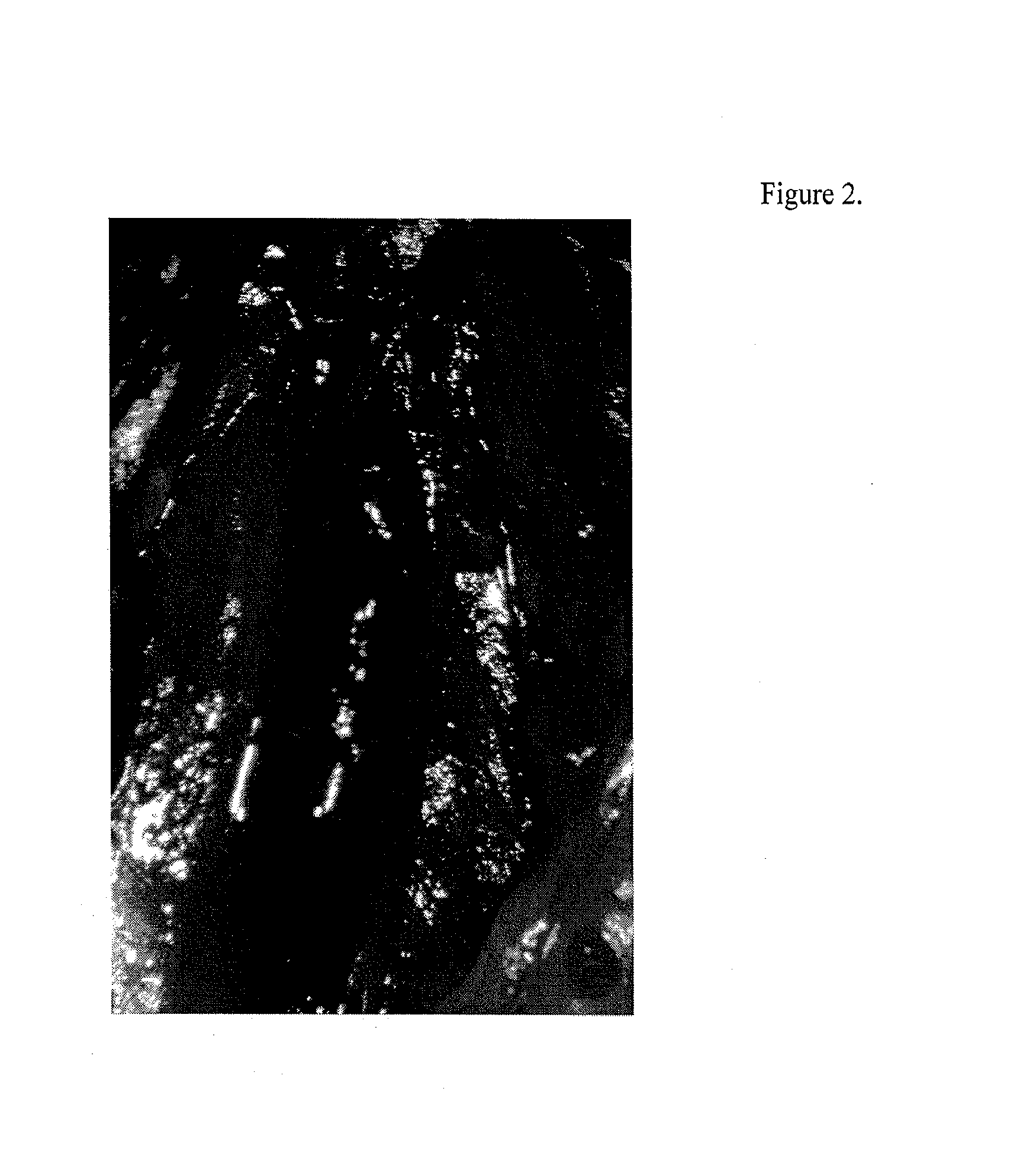 Accelerating Thrombus Resolution Through Augmentation of p53 Activity