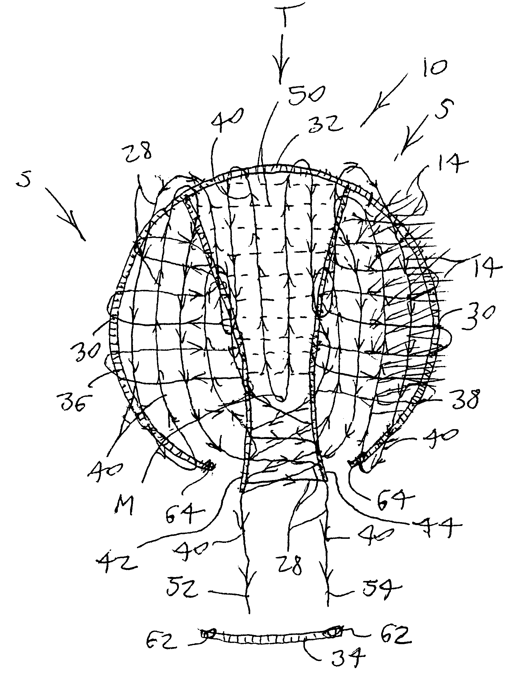 Uniformly size adjustable hair-enhancing cap and methods of manufacture and of custom fitting