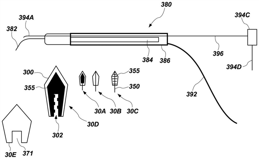 Method and apparatus for periodontal scaling and debridement and gingival tissue ablation for the treatment of periodontal and peri-implant disease