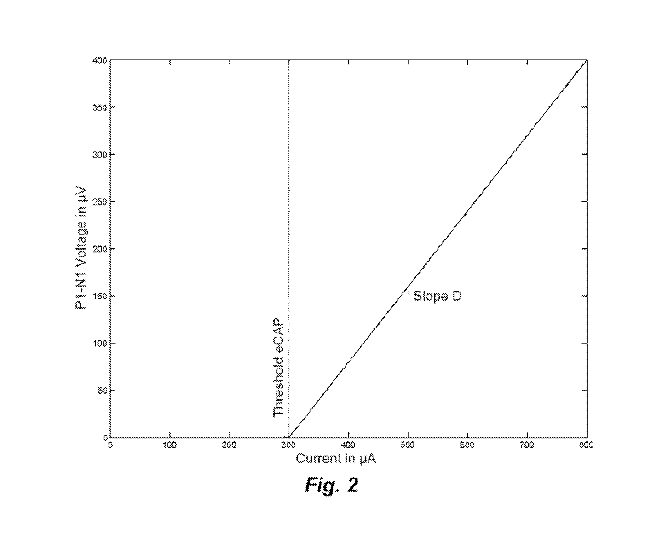 Objective Allocation of Implant Electrode Bands Based on Excitation Spread