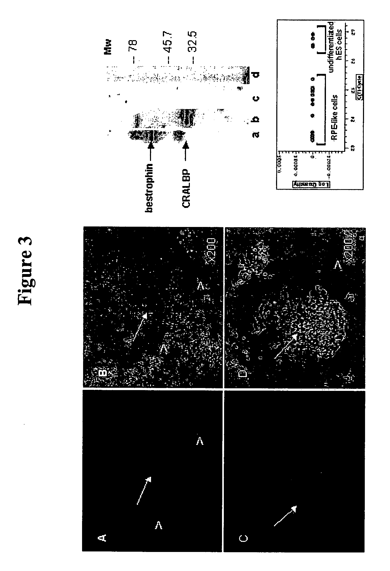 Modalities for the treatment of degenerative diseases of the retina