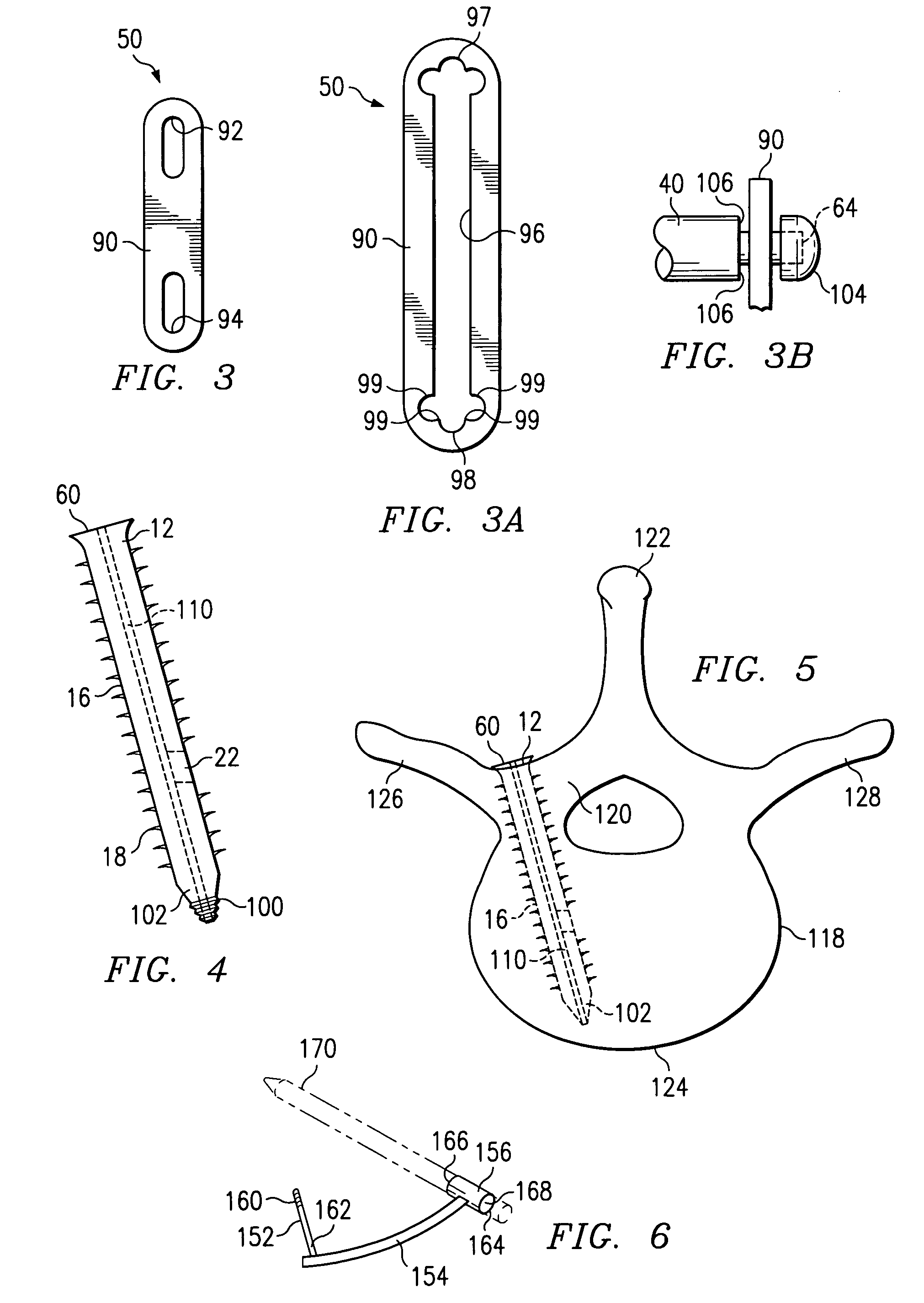 Vertebral stabilization assembly and method