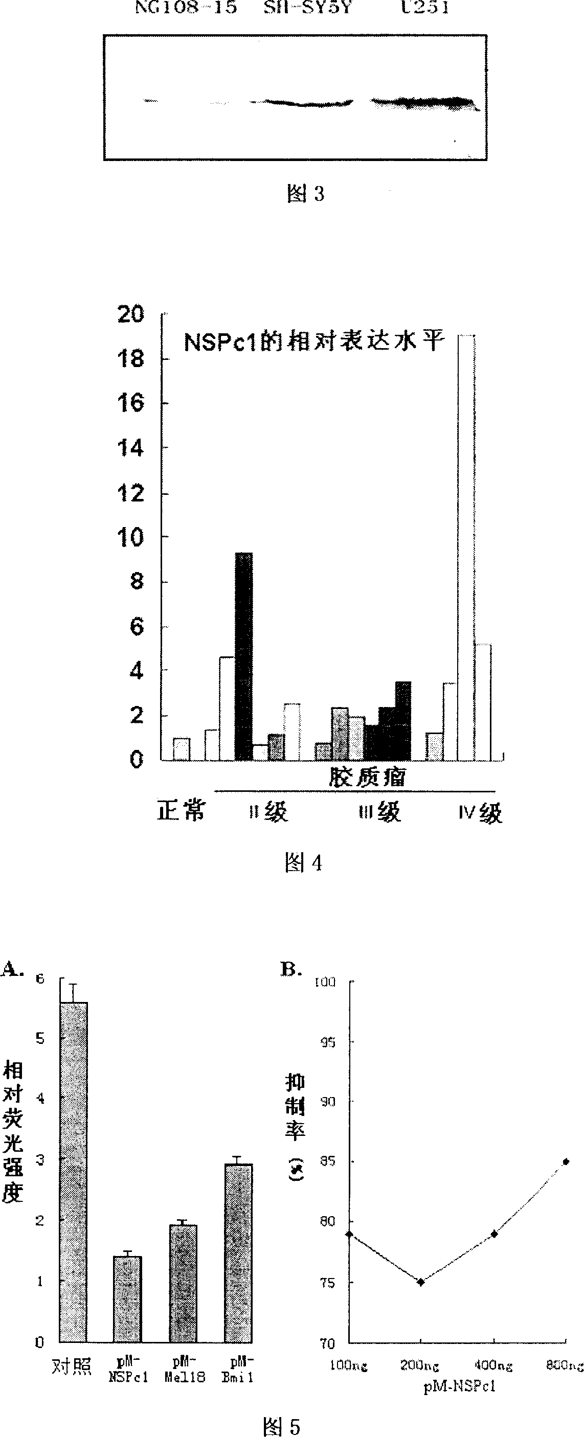 Neural protein NSPc1 having influence on nerve tumor cell differentiation by tretinoin signal pathway