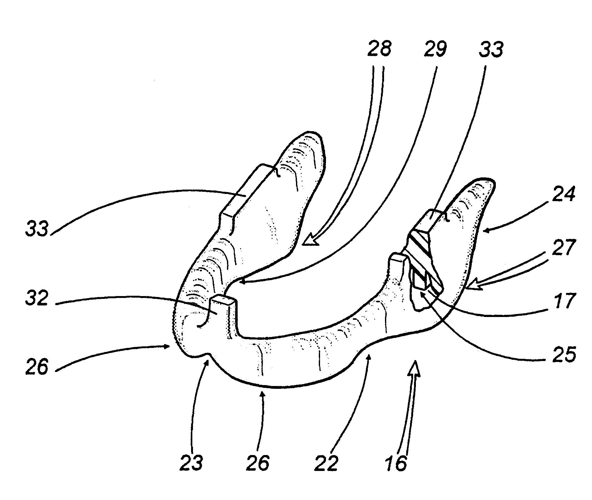 Series of single-use print holders for edentulous patients and method for the realization of total prostheses