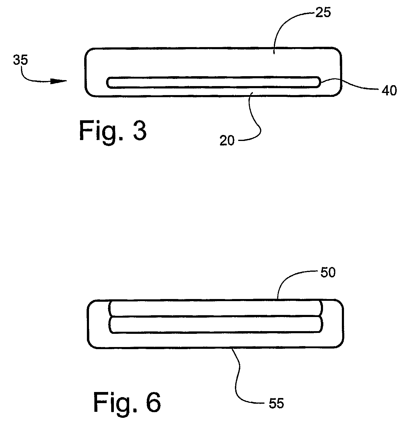 Elastomeric Hand and Foot Protector