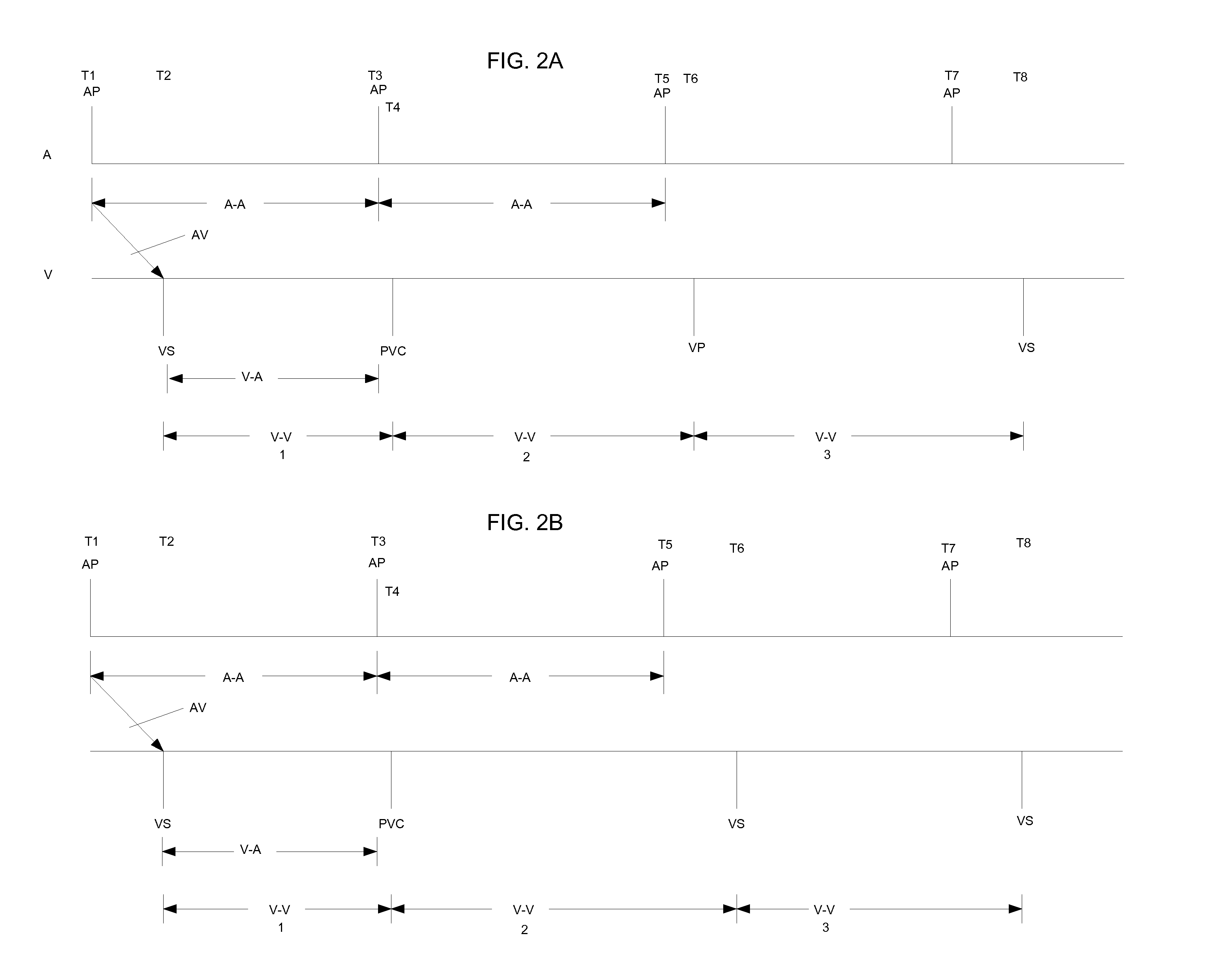 System and Method for Promoting Intrinsic Conduction Through Atrial Timing