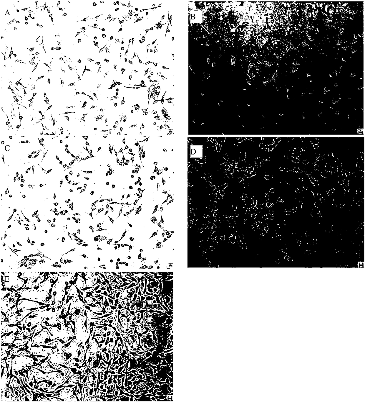 Huang Xiang neem-lily bulb extract for preventing and treating propionibacterium acnes and application thereof