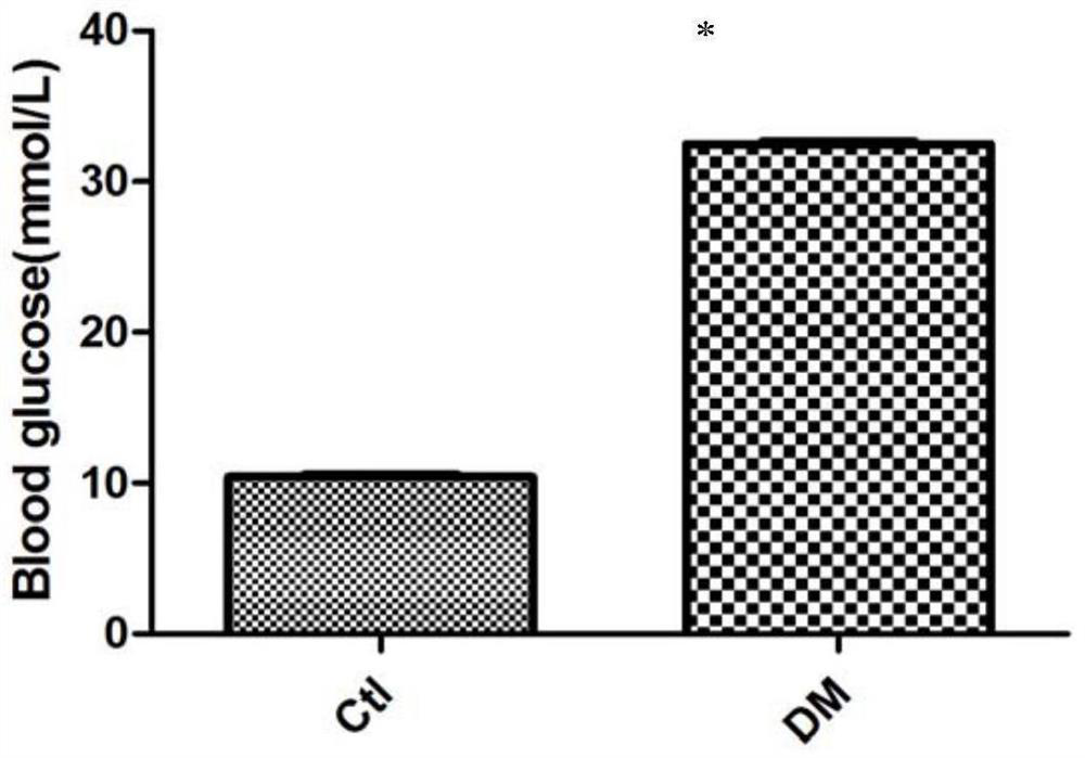 Application of Growth Differentiation Factor-11 in Promoting Diabetic Wound Healing