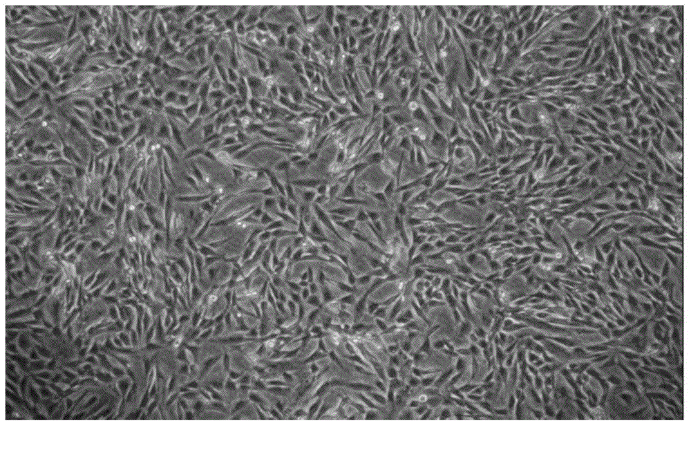 Method for preparing decidua mesenchymal stem cell