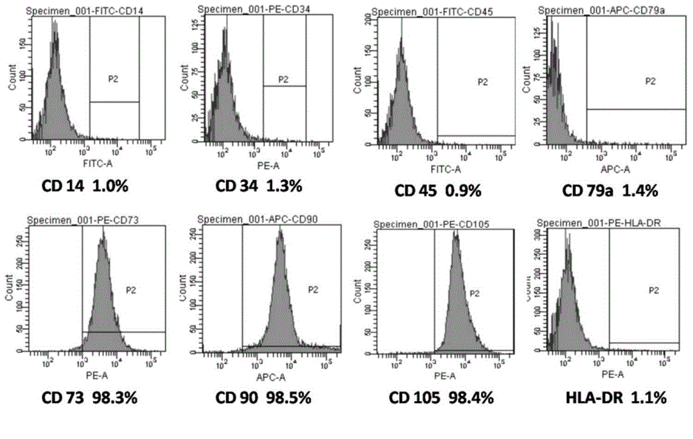 Method for preparing decidua mesenchymal stem cell