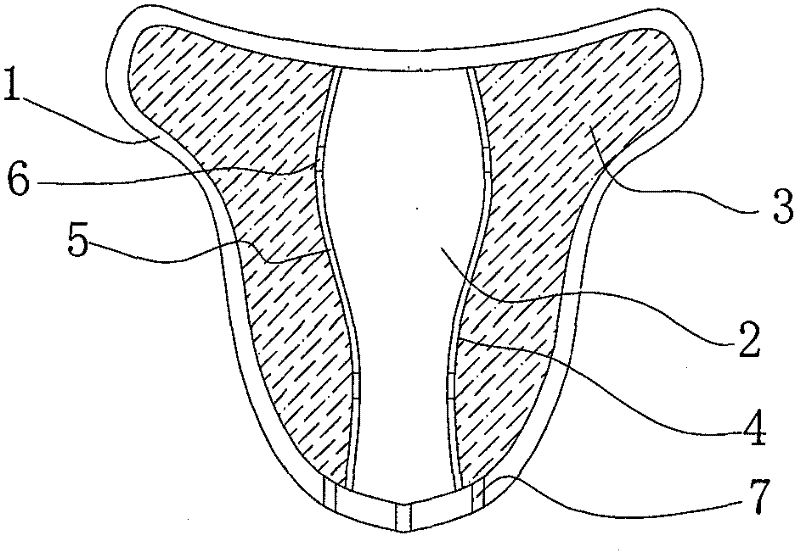 Intrauterine adhesion prevention and cure device