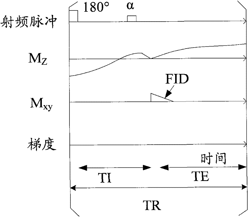 Method and system for calculating quantitative parameter of magnetic resonance imaging