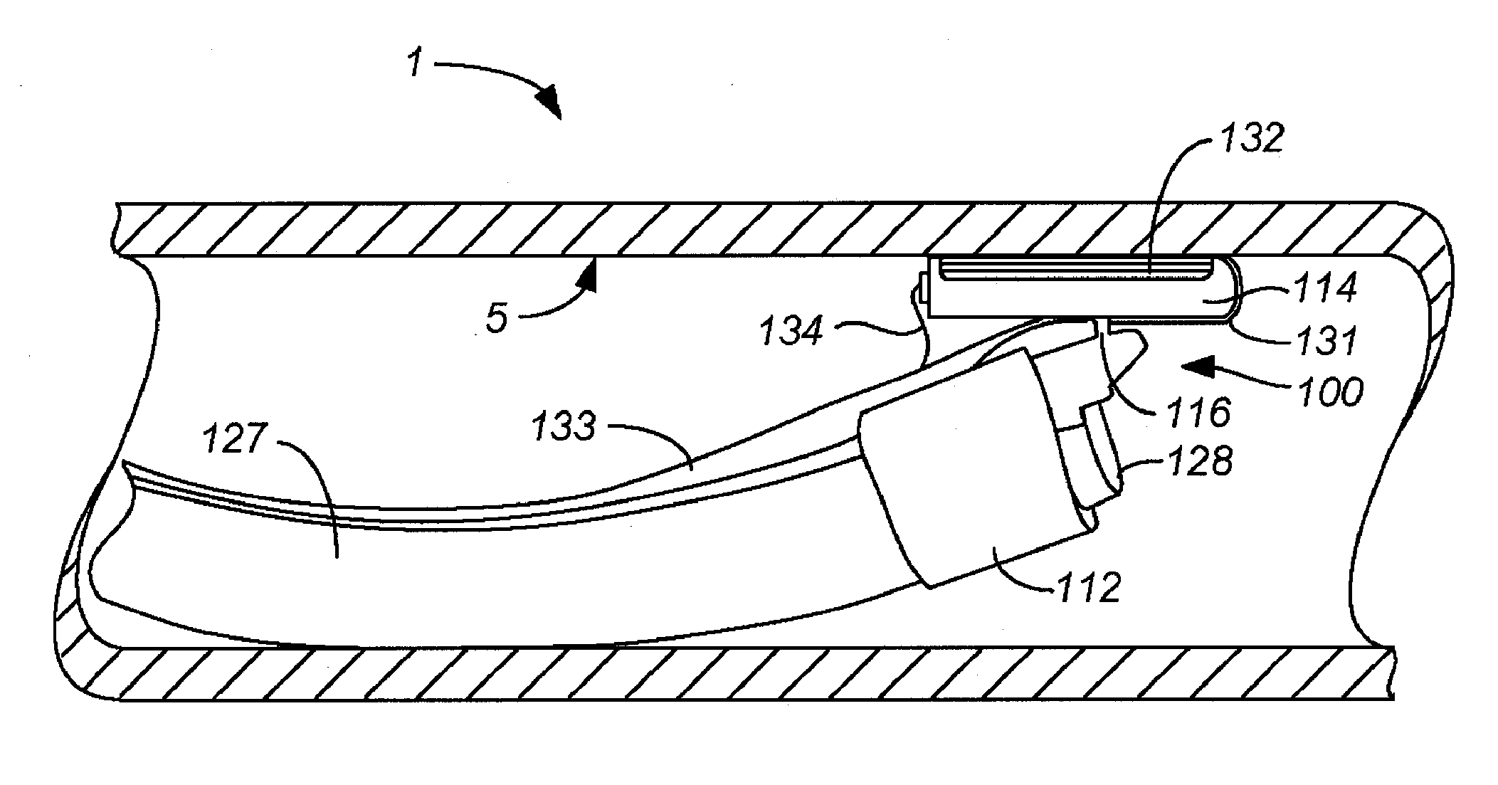 Auto-aligning ablating device and method of use