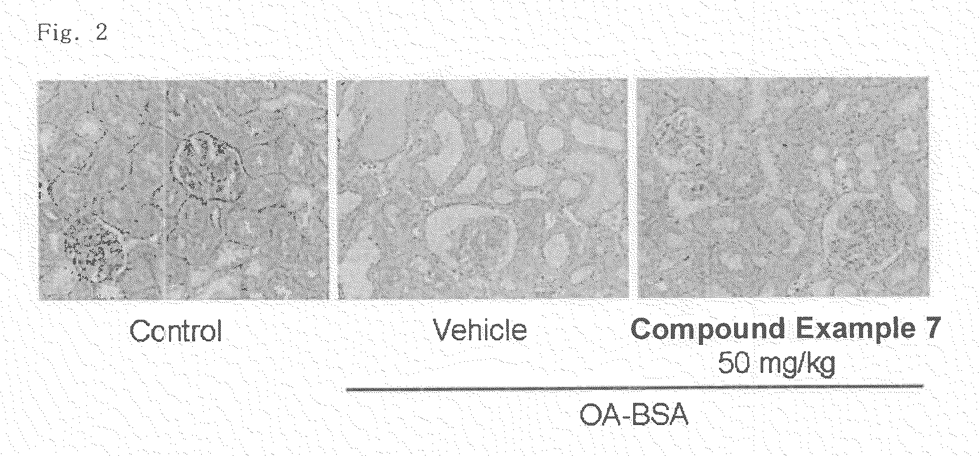 Novel acyl guanidine derivatives