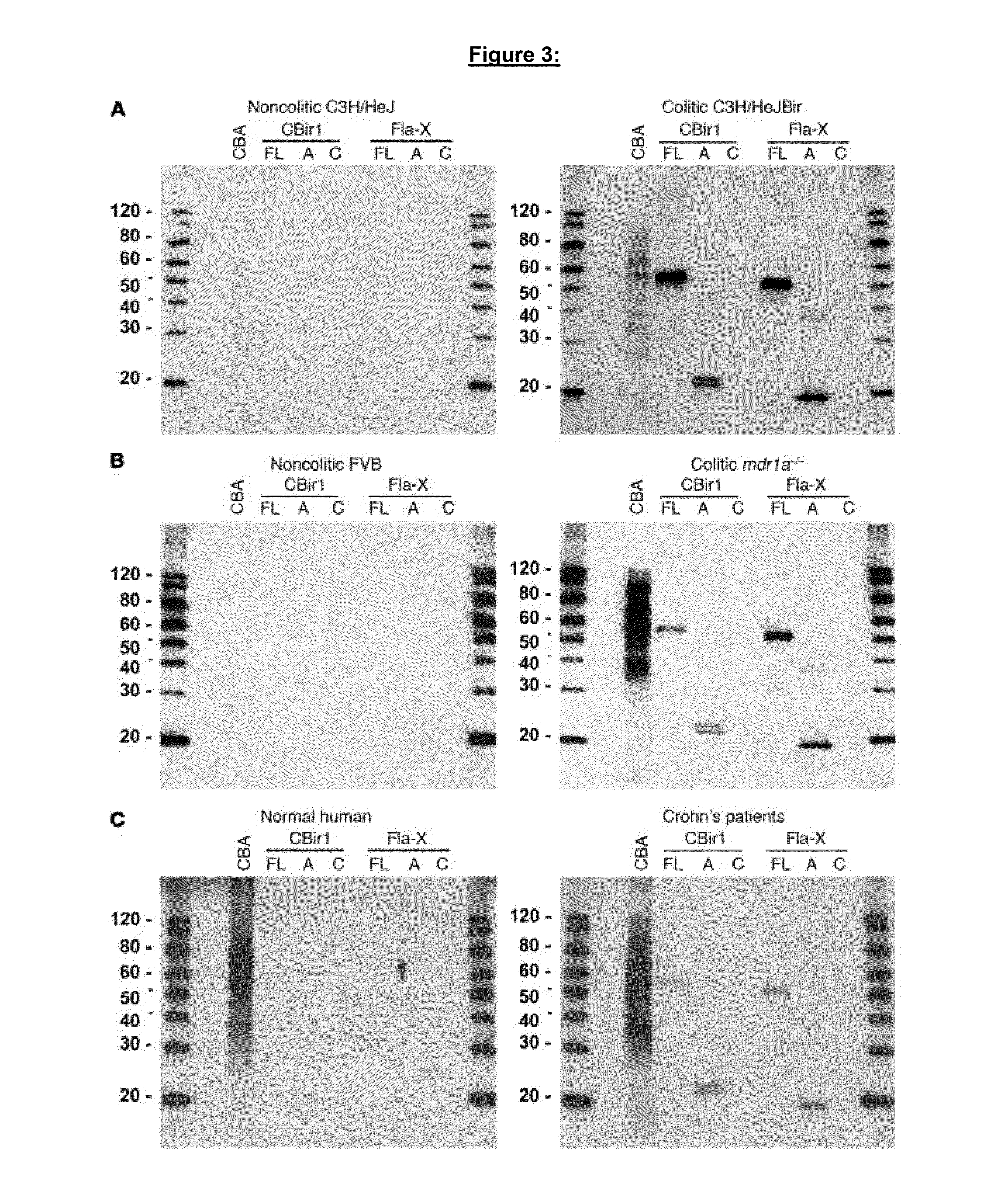 Diagnosis and treatment of inflammatory bowel disease