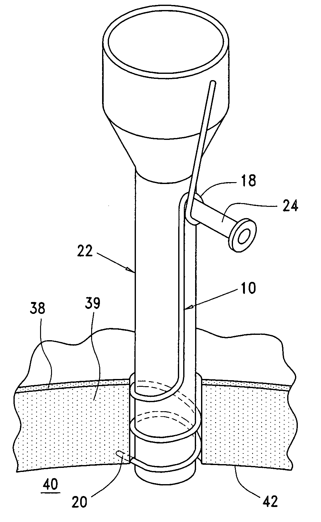 Cannula delivery and support system