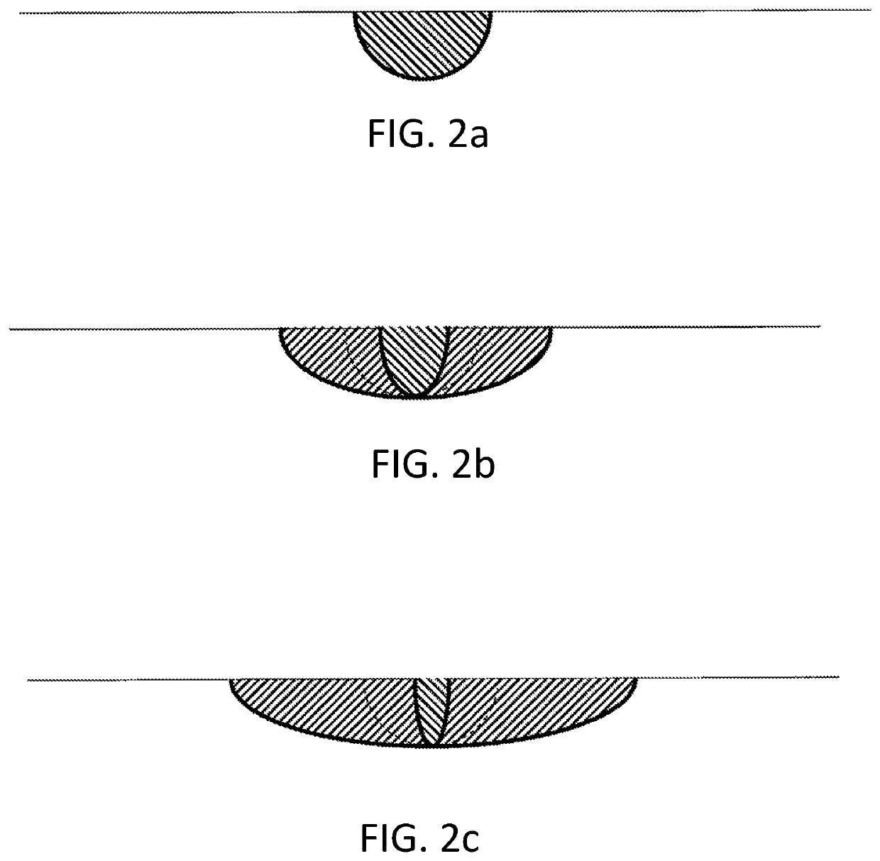 Soft tissue selective ablation surgical systems