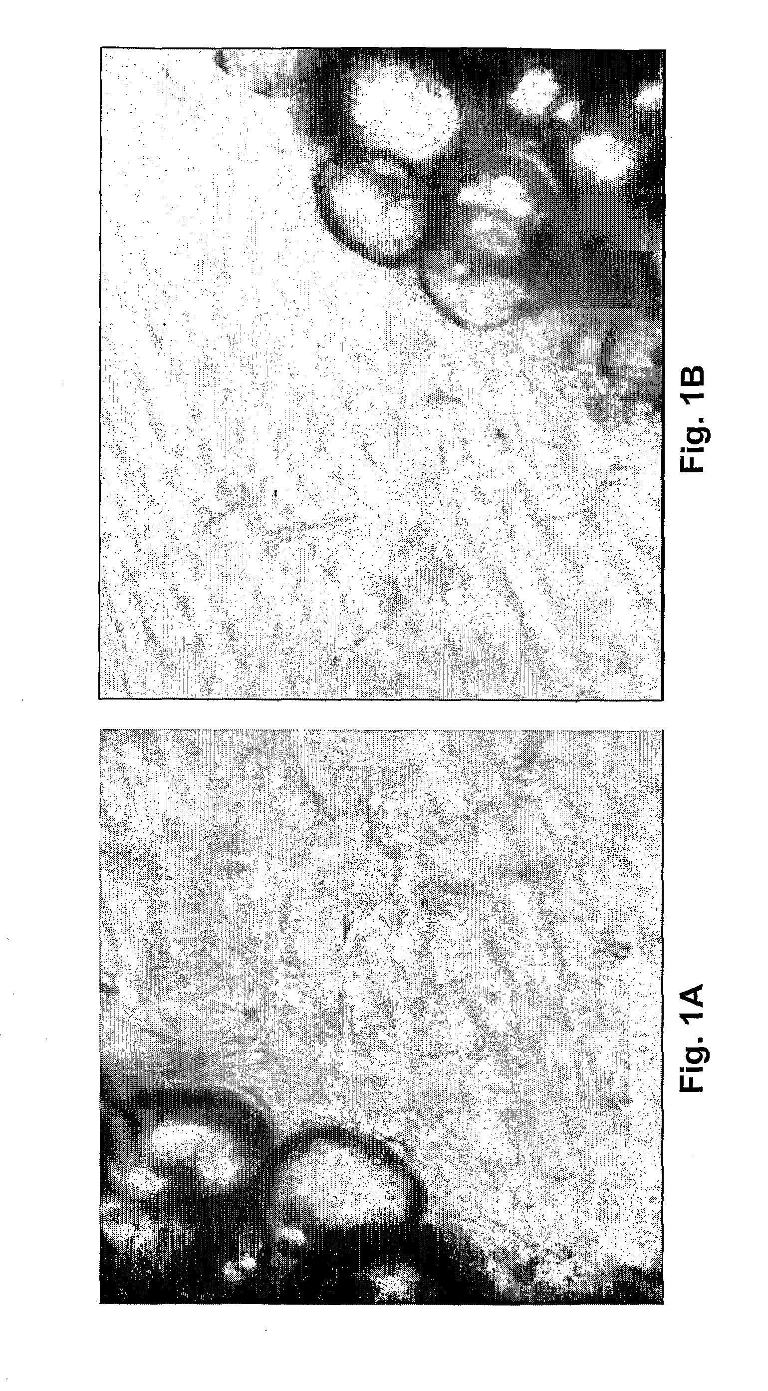 Enterostatin as Inhibitor of Angiogenesis