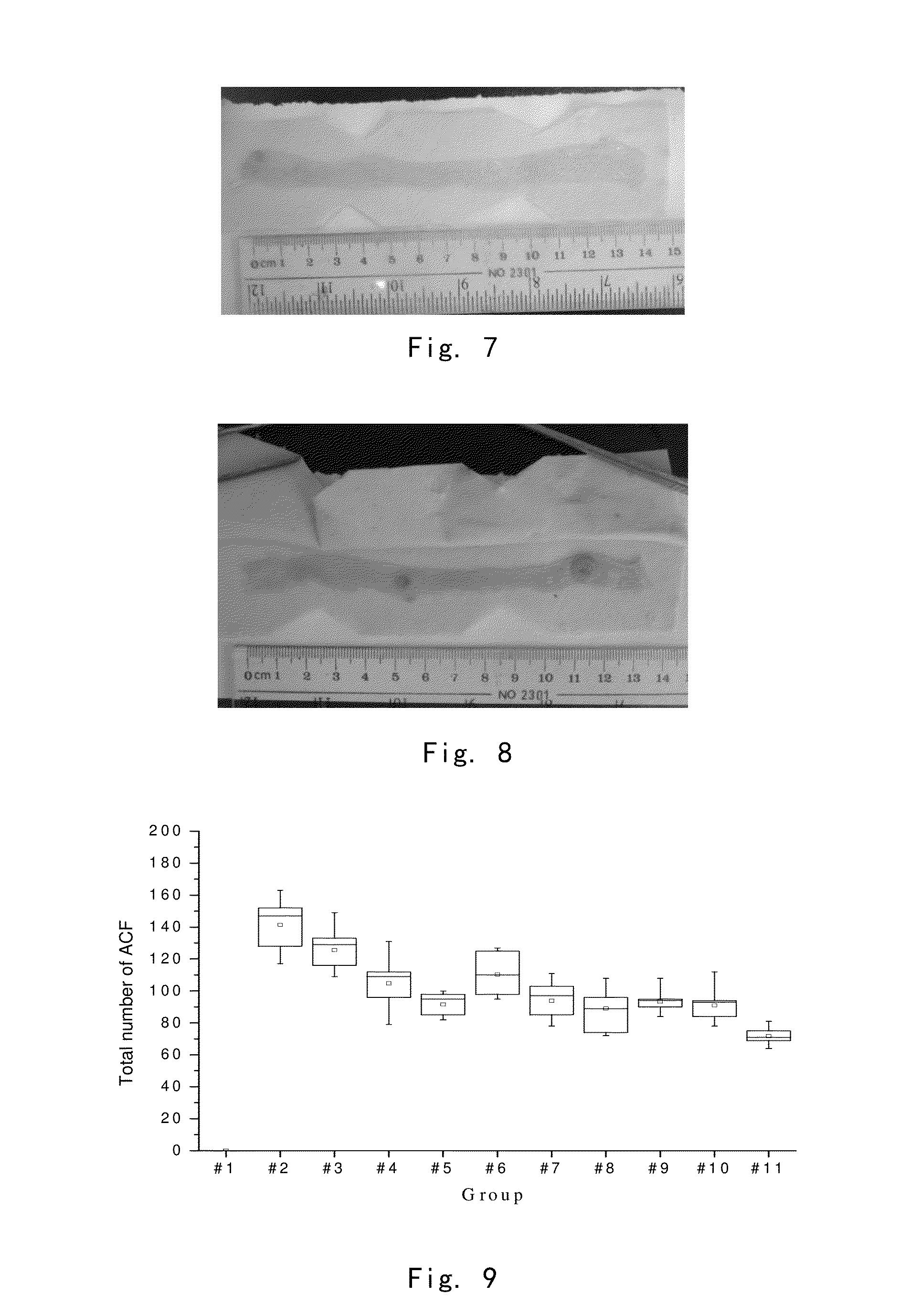 Medicine composition containing vitamin d and metformin