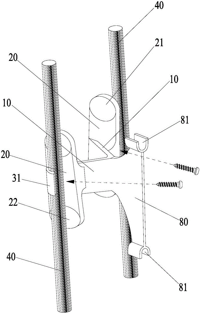 Spine fixing assembly