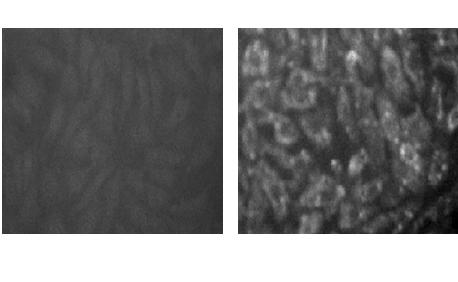 Detection method for agglutination test of rabies virus neutralizing antibody cells