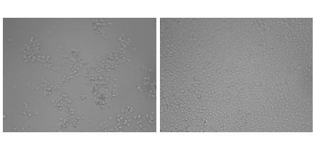 Detection method for agglutination test of rabies virus neutralizing antibody cells