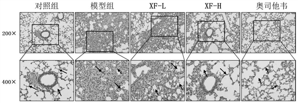 Application of lung-ventilating and toxin-vanquishing prescription to preparation of medicine for preventing and/or treating pneumonia caused by influenza A virus H1N1