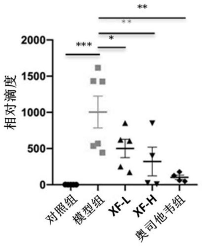 Application of lung-ventilating and toxin-vanquishing prescription to preparation of medicine for preventing and/or treating pneumonia caused by influenza A virus H1N1