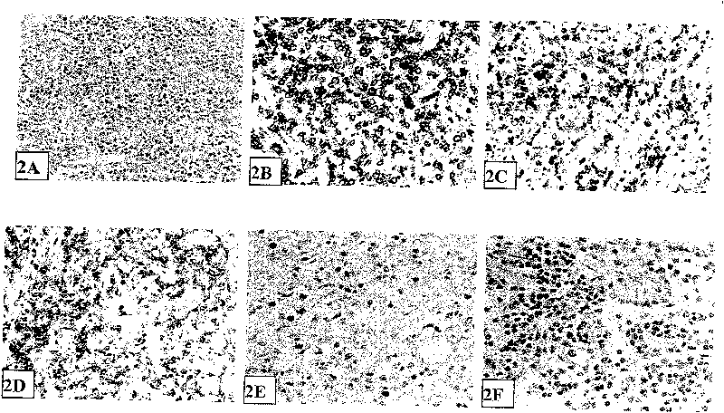 Method for establishing extranodal nasal type NK/T-celllymphoma animal model