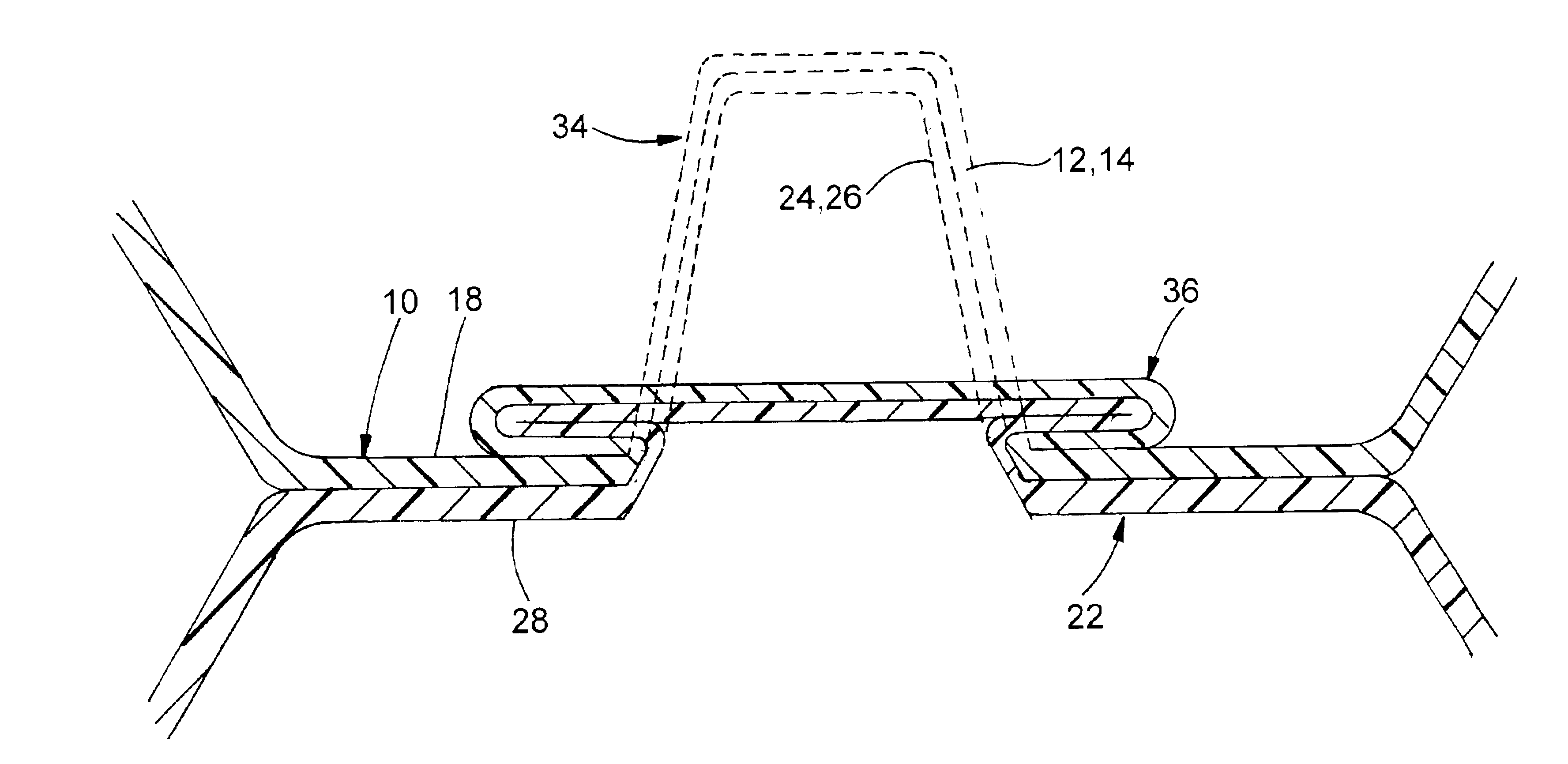 Method of making contact bodies