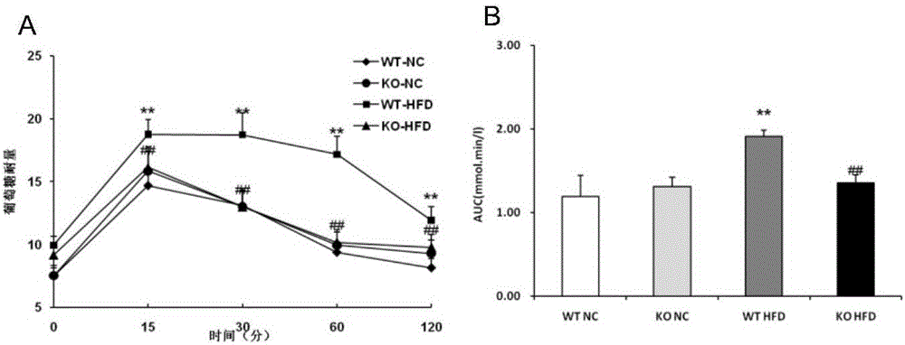 Function and application of three-structural-domain protein 8 in treating non-alcoholic fatty liver disease and II type diabetes mellitus