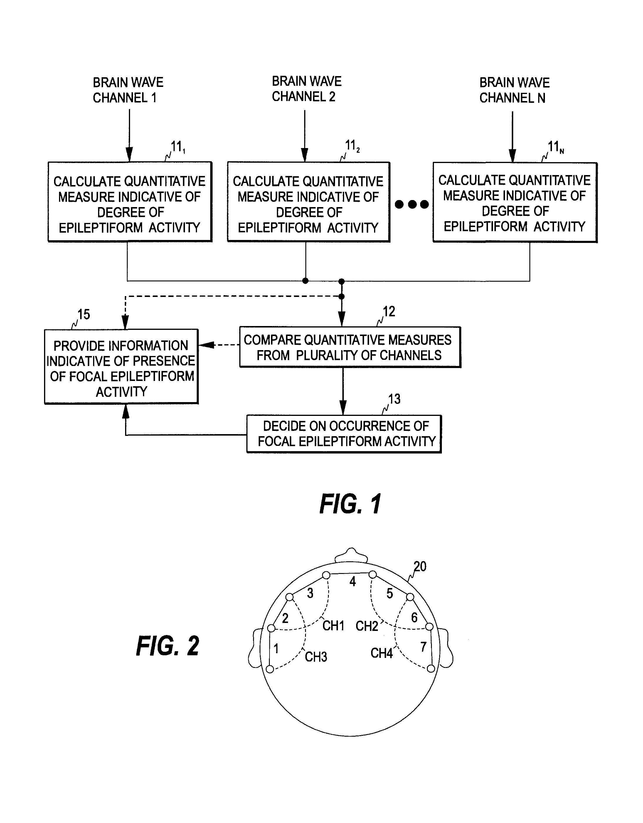 Detection of focal epileptiform activity