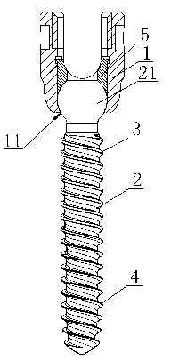 Spine bolt