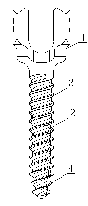 Spine bolt