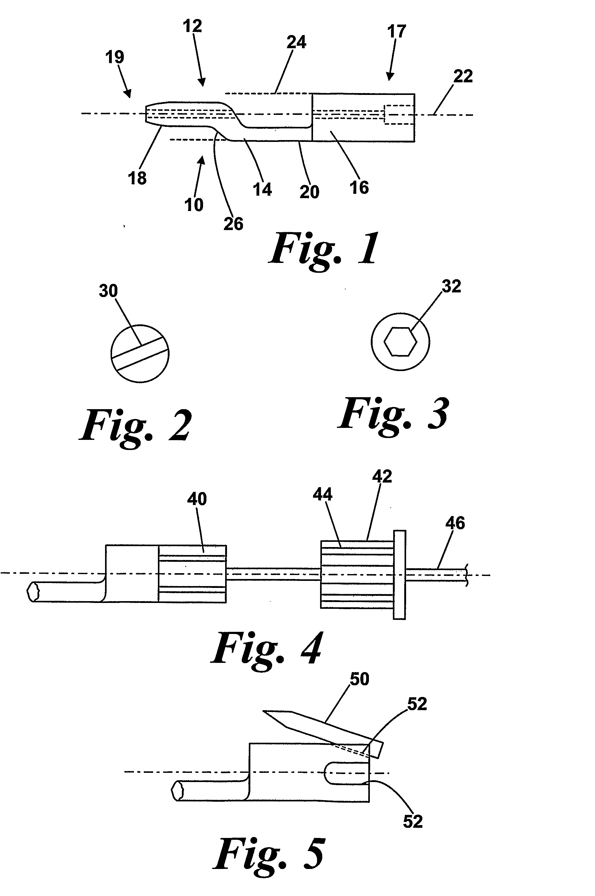 Adjustable ligament graft fixation