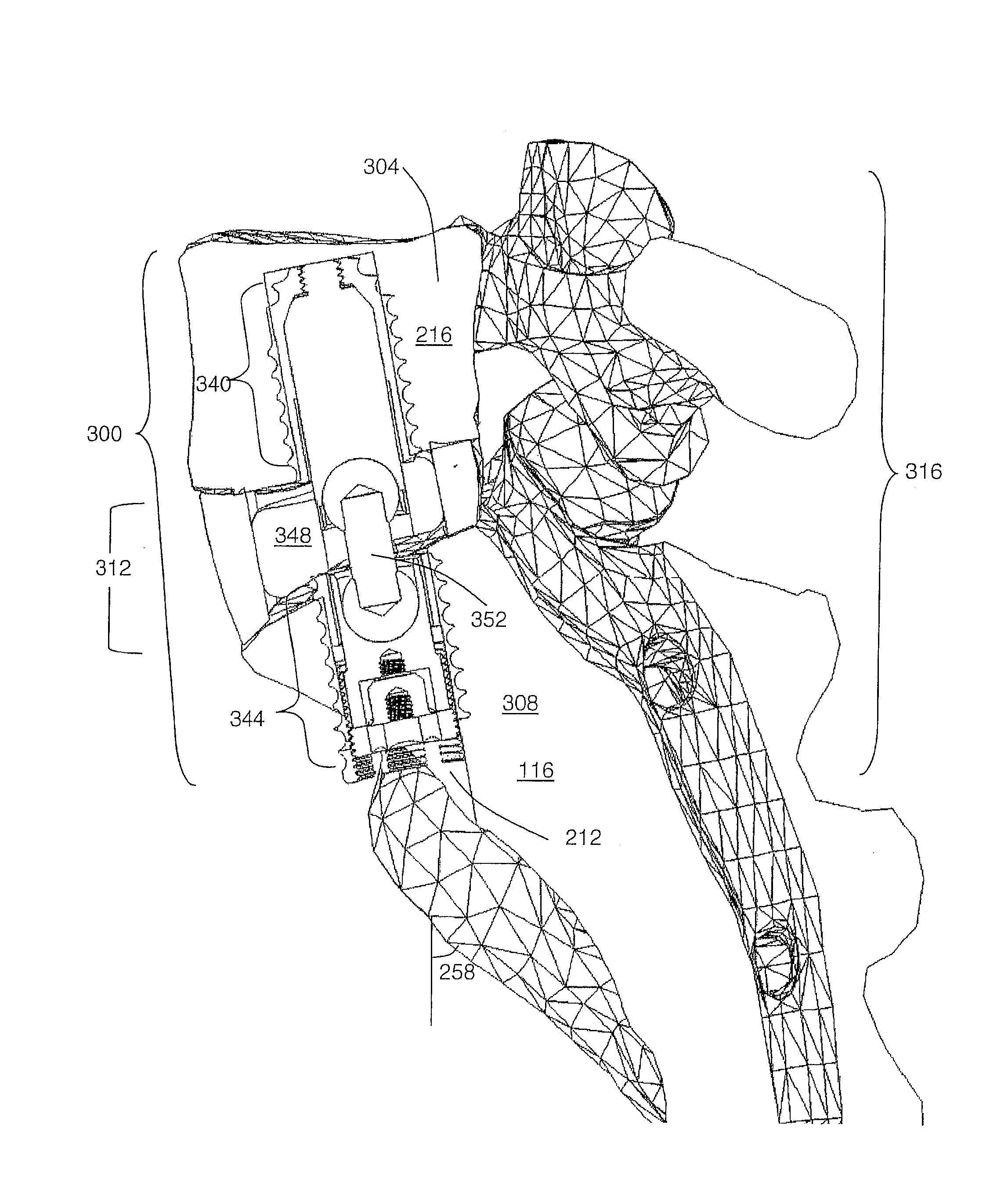 Preformed membranes for use in intervertebral disc spaces