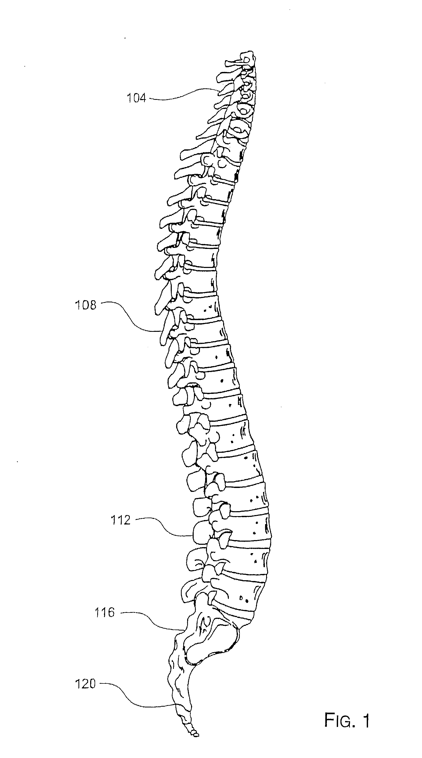 Preformed membranes for use in intervertebral disc spaces