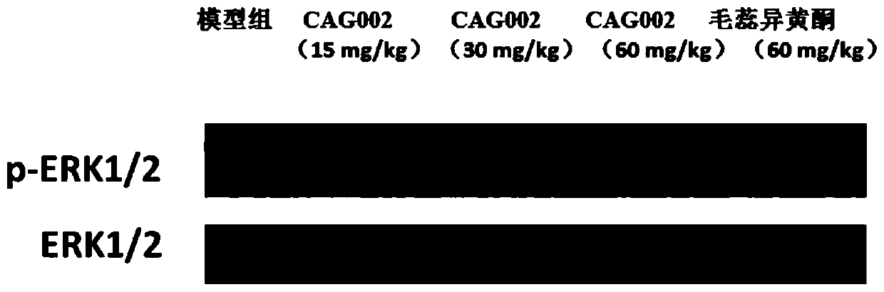 Application of Calycosin Derivatives in Preparation of Drugs for Treating Cerebral Ischemia-Reperfusion Injury