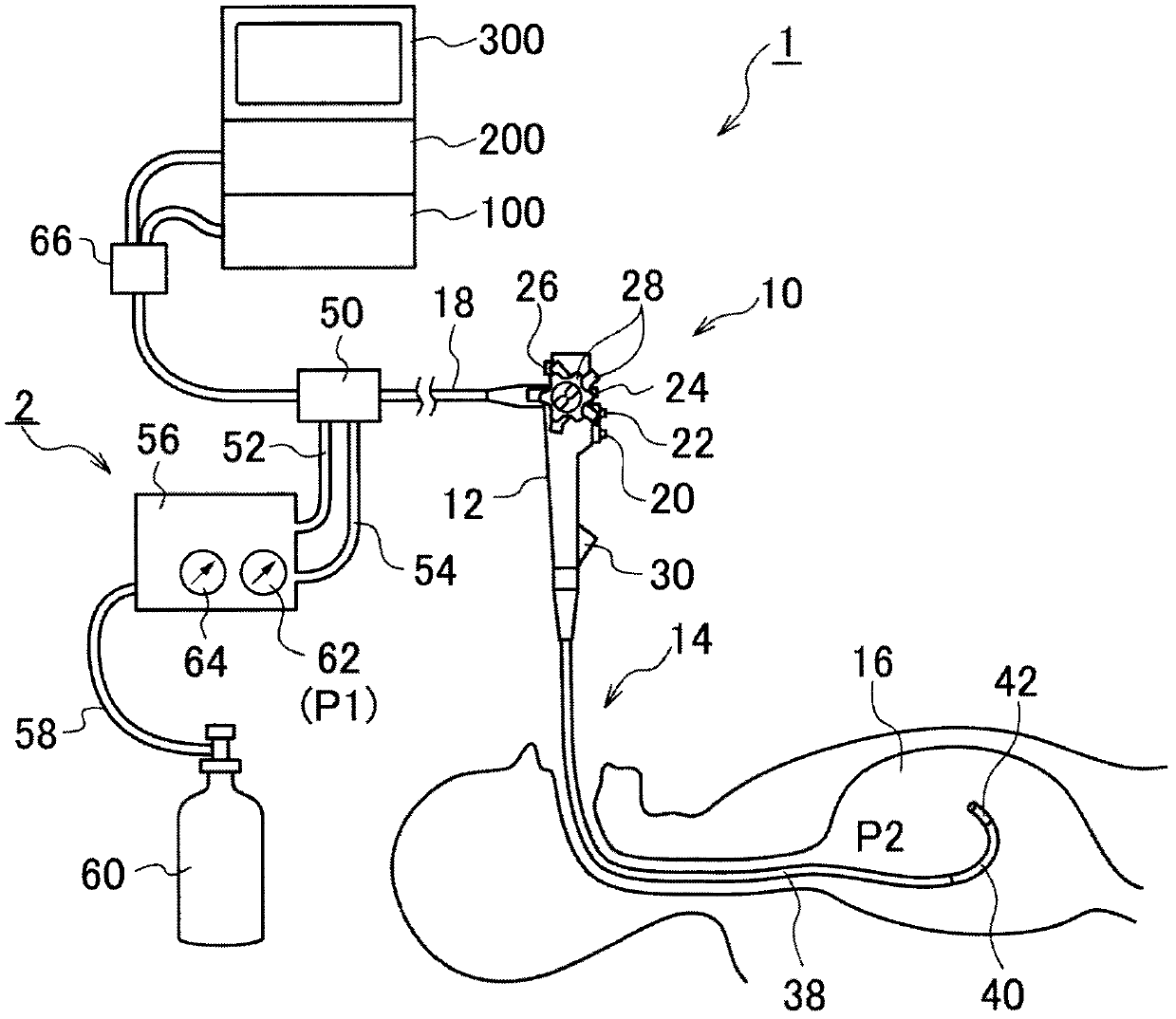 Endoscope air-supply system