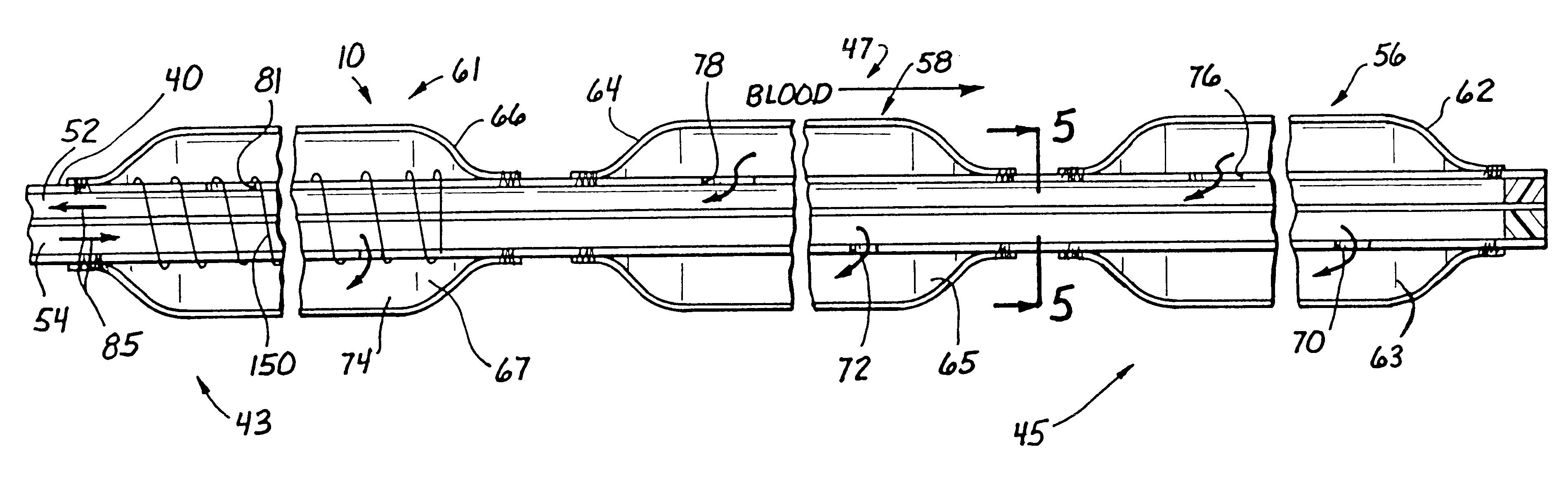 Indwelling heat exchange catheter and method of using same