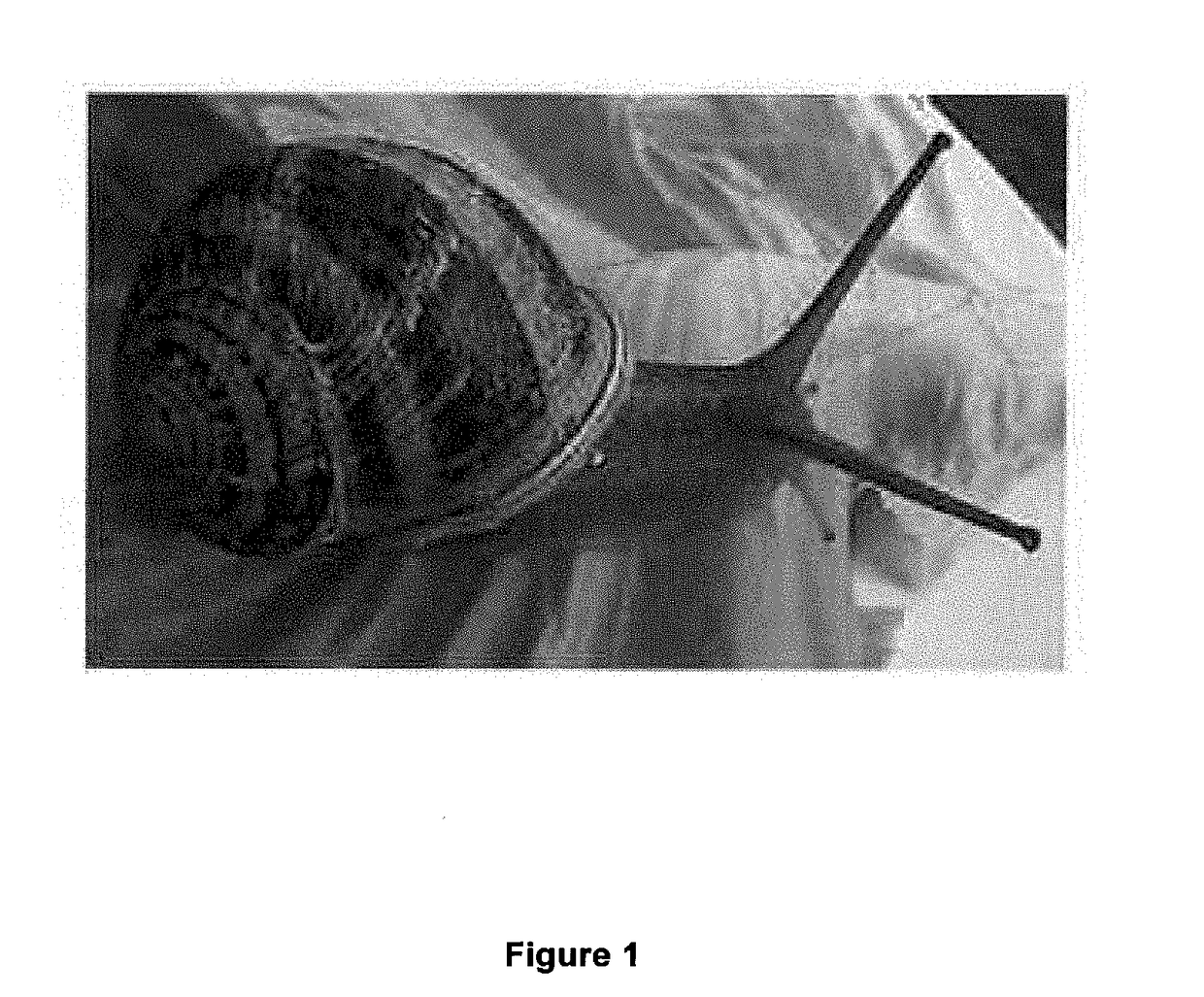 Pharmaceutical composition for preventing, treating and curing rosacea, comprising snail slime, chamomile and propolis