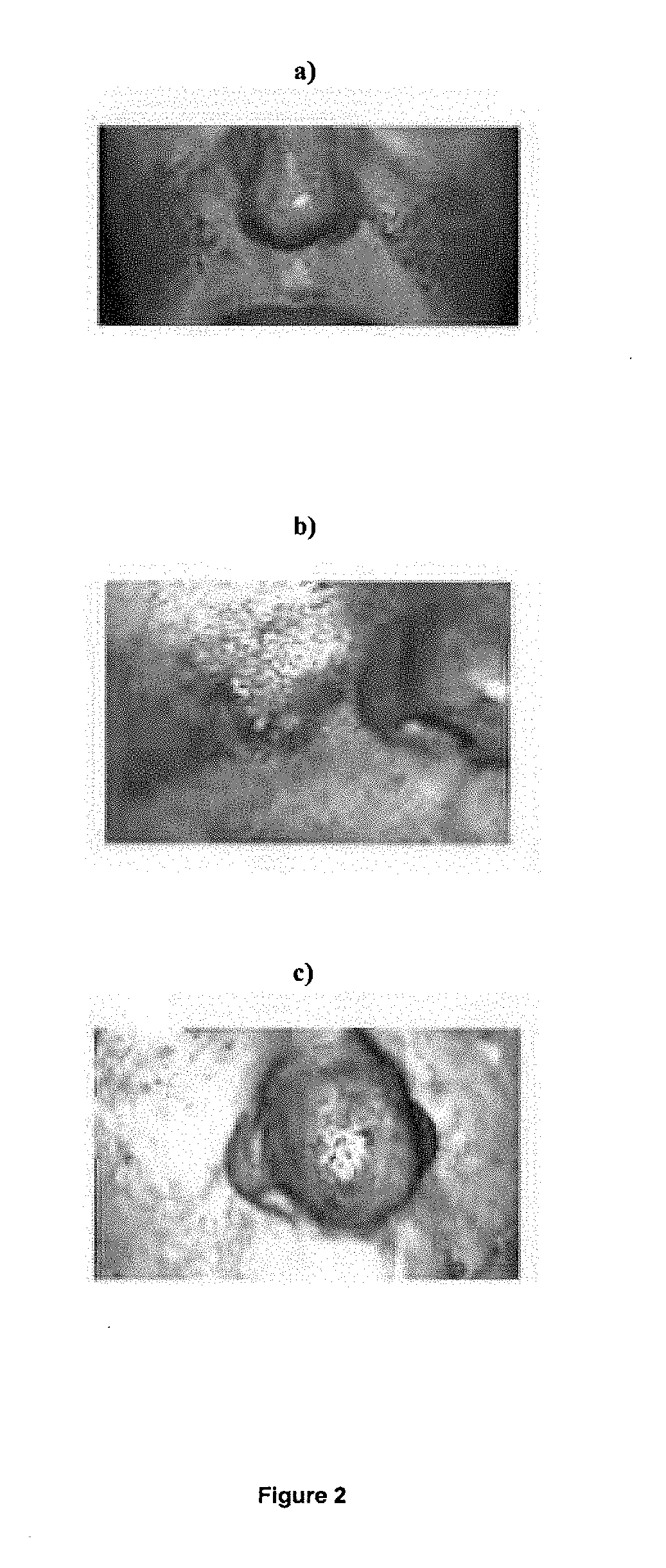 Pharmaceutical composition for preventing, treating and curing rosacea, comprising snail slime, chamomile and propolis