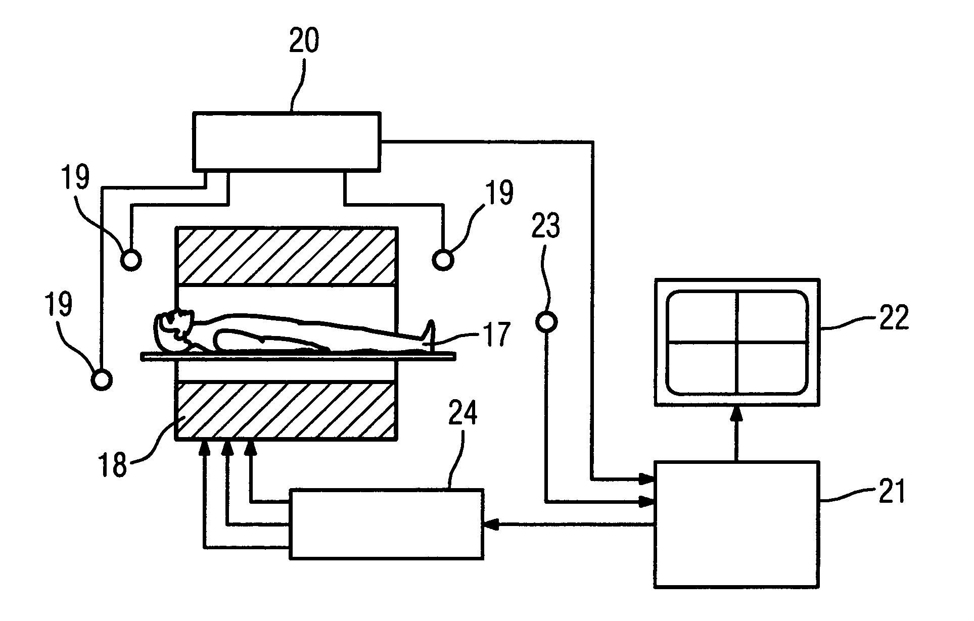 Device for introducing a stent into a hollow organ