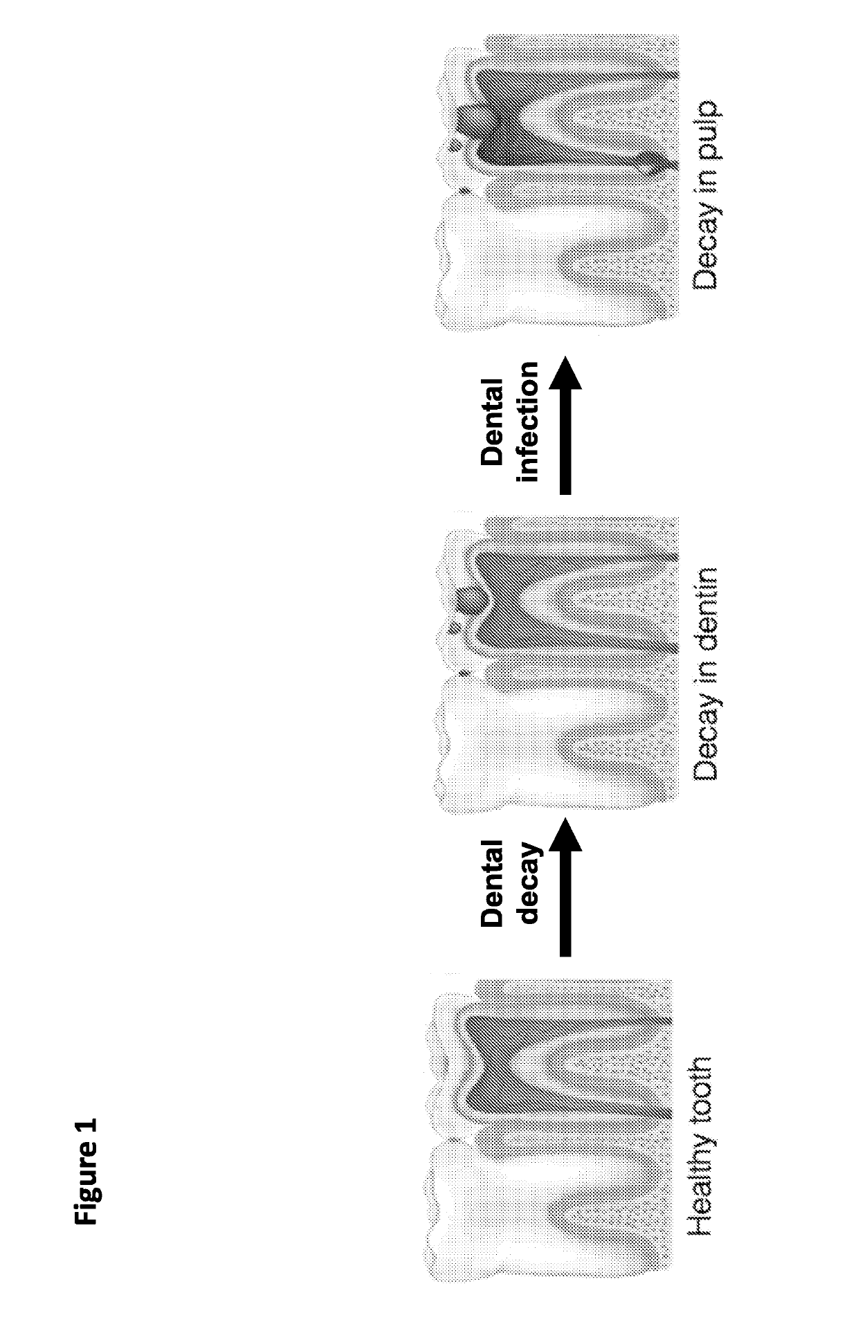 Methods and compositions for dental tissue repair and/or regeneration