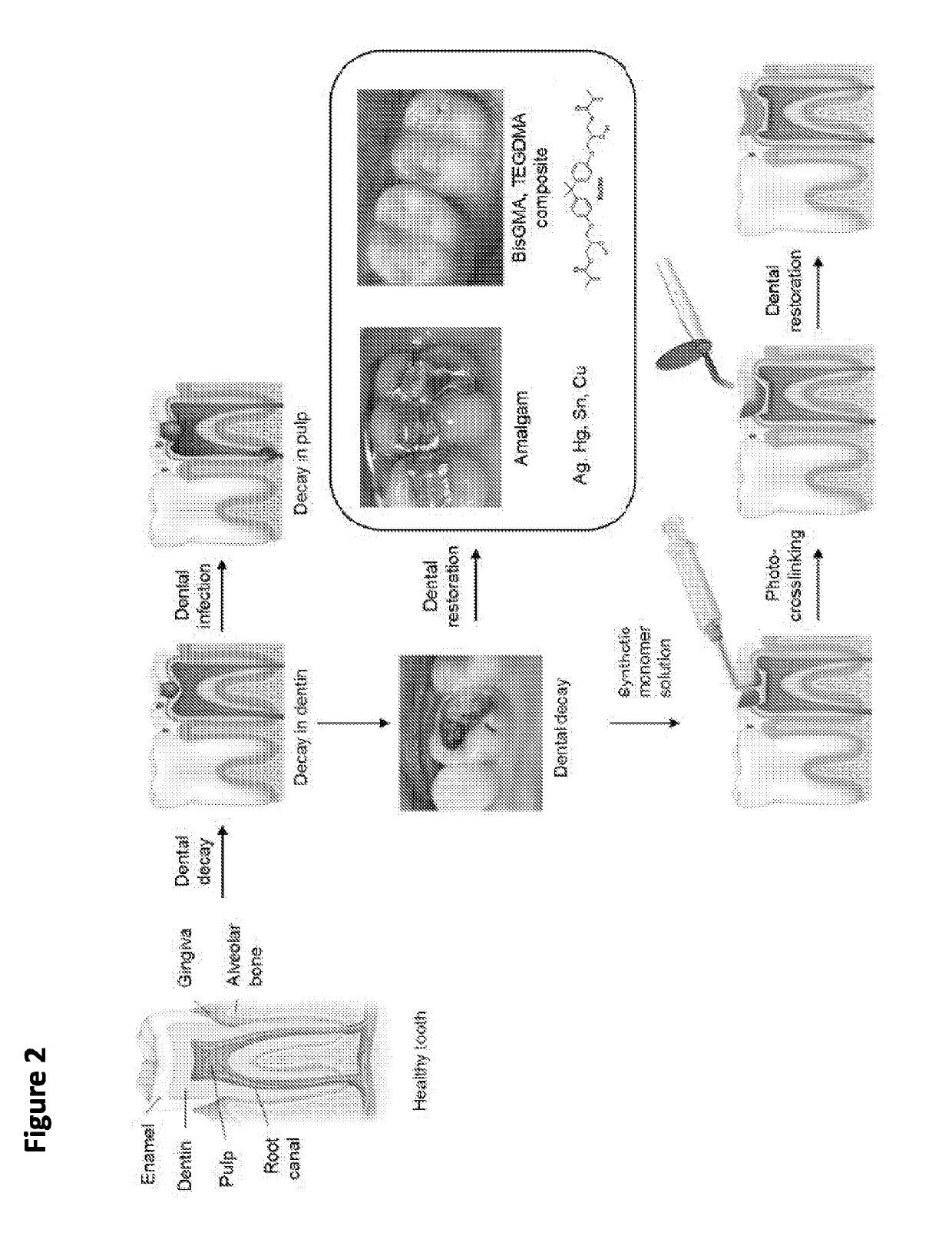 Methods and compositions for dental tissue repair and/or regeneration