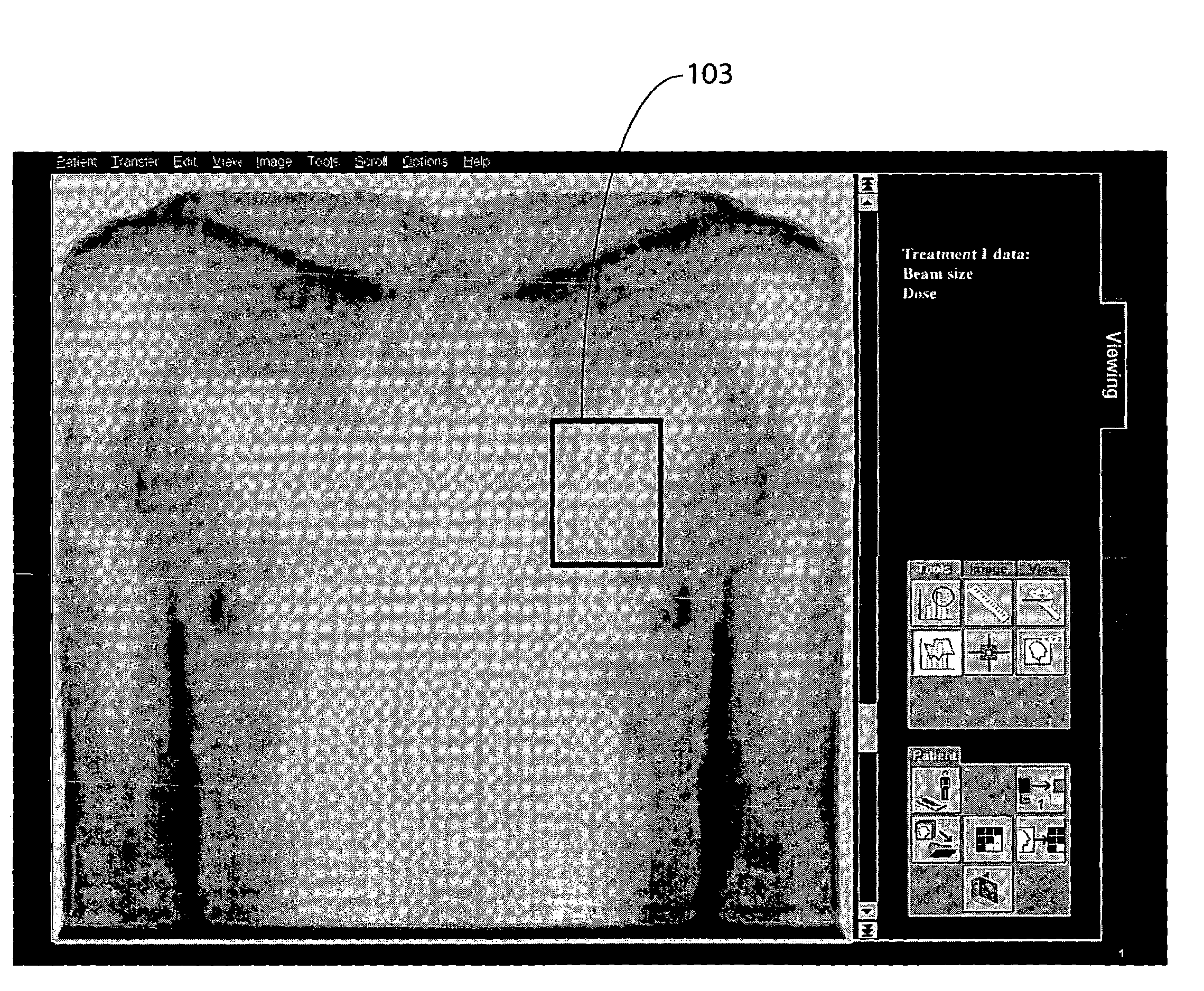 Beam therapy treatment user interface monitoring and recording system