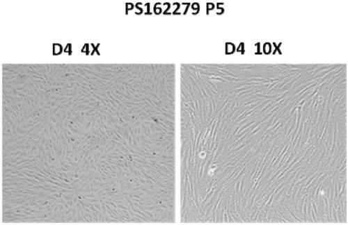 Method for treating sclerosis using placental mesenchymal stem cell preparation