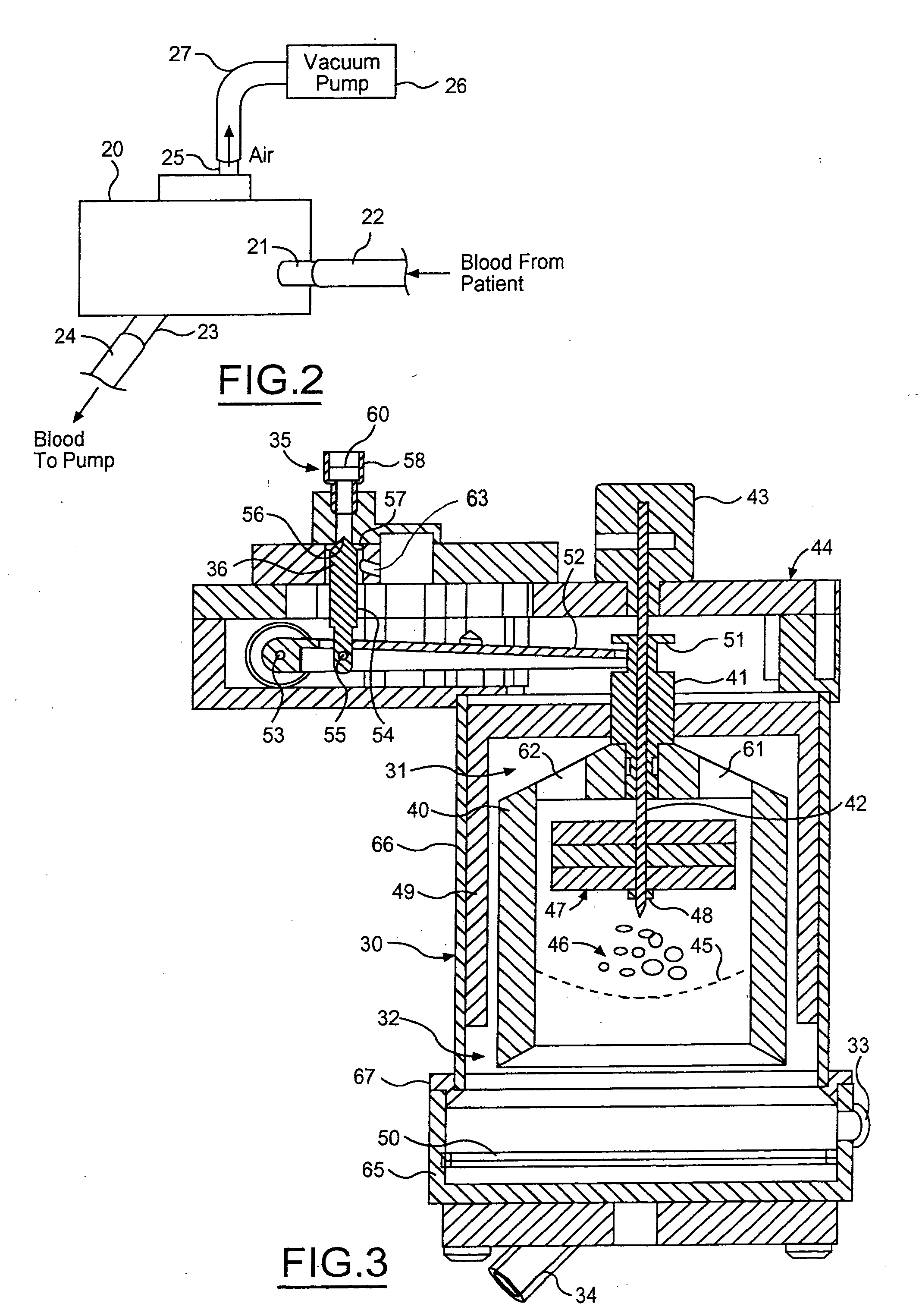 Float-driven lever arm for blood perfusion air removal device