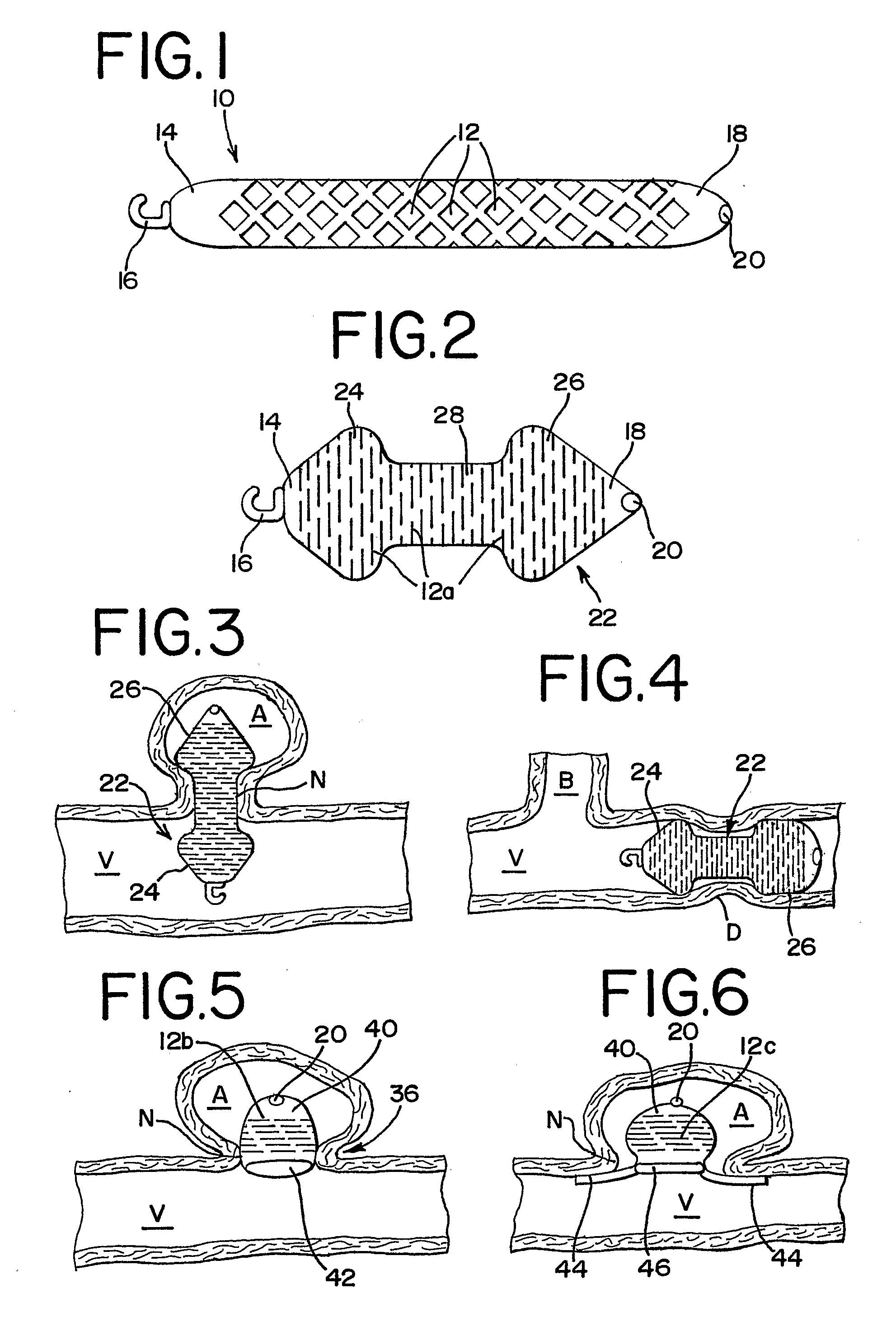 Thin Film Metallic Device for Plugging Aneurysms or Vessels